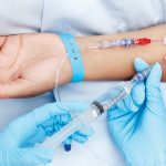 Gli accessi vascolari e la creazione di un bundle operativo