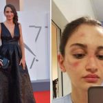 Alessia Bonari, infermiera simbolo della lotta al Covid, sul red carpet di Venezia