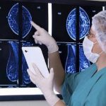 Carcinoma mammario, bando di ricerca segnalato da Aiom