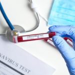 Coronavirus, Anelli (Fnomceo): "No ai test sierologici autosomministrati"