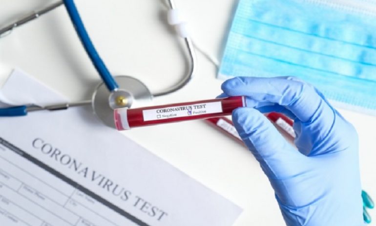 Coronavirus, Anelli (Fnomceo): "No ai test sierologici autosomministrati"