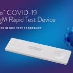 Coronavirus, arriva un nuovo test antigenico rapido: risultati in soli 15 minuti