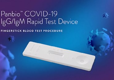 Coronavirus, arriva un nuovo test antigenico rapido: risultati in soli 15 minuti