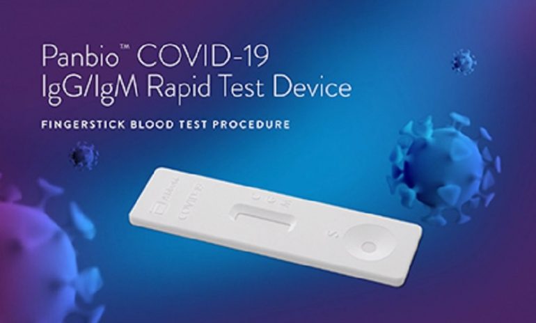 Coronavirus, arriva un nuovo test antigenico rapido: risultati in soli 15 minuti