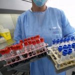 Coronavirus, minor rischio di contagio per chi ha il gruppo sanguigno 0?