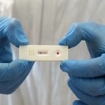 Coronavirus, ok del ministero ai test sierologici in farmacia