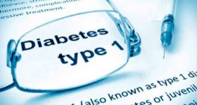 Diabete, si potrà "dimenticare" grazie al pancreas artificiale