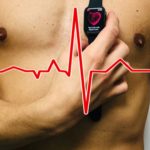 Infarto: la diagnosi precoce con lo smartwatch
