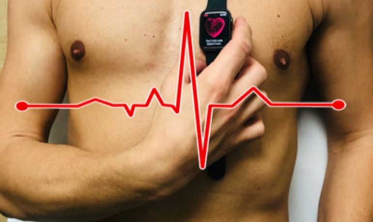 Infarto: la diagnosi precoce con lo smartwatch