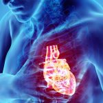 Infarto: nuove terapie e strategie di prevenzione grazie a uno studio sulle placche aterosclerotiche