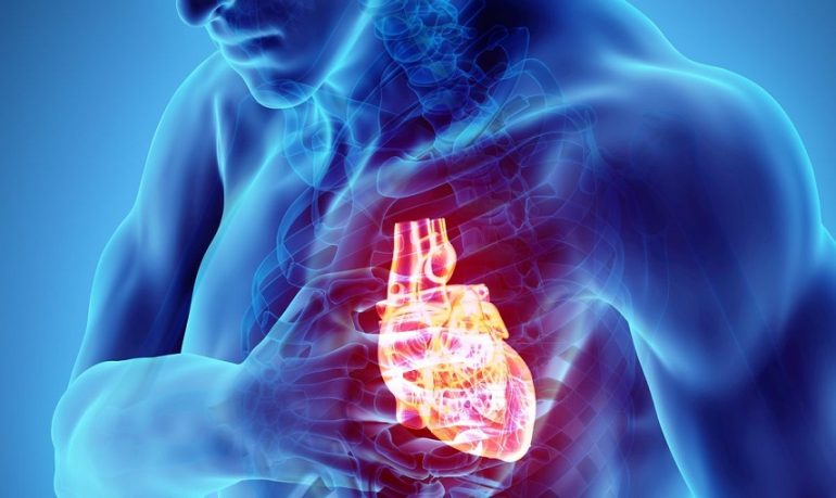 Infarto: nuove terapie e strategie di prevenzione grazie a uno studio sulle placche aterosclerotiche