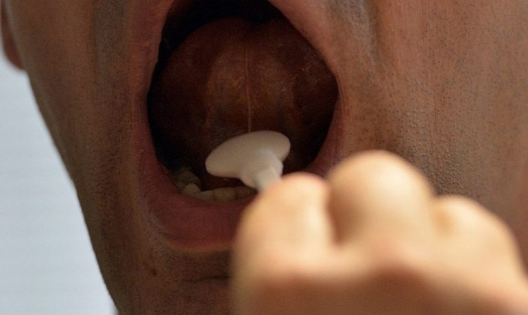 Infarto, un test della saliva può accelerare la diagnosi