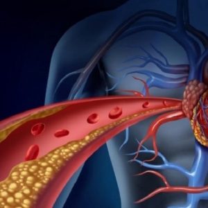 Malattie cardiovascolari: il ruolo dei PCSK9 in caso di colesterolo alto