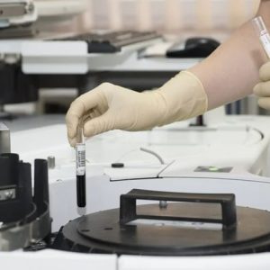 Tumore al colon-retto: due farmaci per contrastarlo