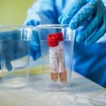 Coronavirus, anziana morta per reinfezione: primo caso al mondo