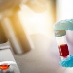 Coronavirus, due super anticorpi per bloccare l'ingresso nelle cellule