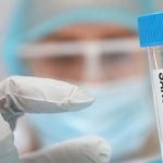 Coronavirus, studio Iss suggerisce nuovi marcatori tumorali
