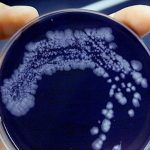 Ortona, è allarme legionella: 5 ricoveri e un decesso