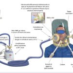 Ventilazione non invasiva: la gestione infermieristica del casco per Terapia CPAP