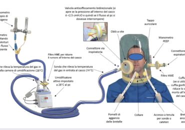 Ventilazione non invasiva: la gestione infermieristica del casco per Terapia CPAP
