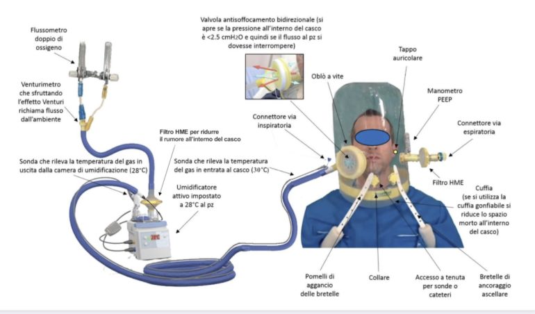 Ventilazione non invasiva: la gestione infermieristica del casco per Terapia CPAP