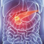Cancro al pancreas: una "macchina del tempo" per osservare le dinamiche delle terapie farmacologiche