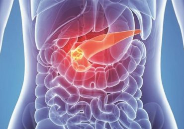 Cancro al pancreas: una "macchina del tempo" per osservare le dinamiche delle terapie farmacologiche