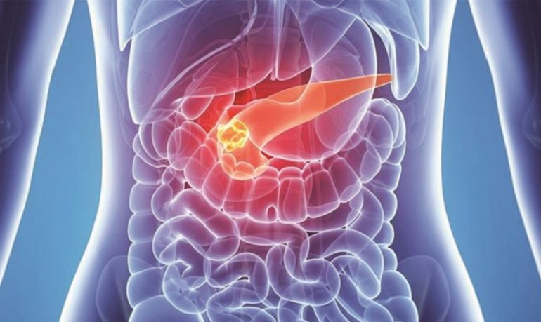Cancro al pancreas: una "macchina del tempo" per osservare le dinamiche delle terapie farmacologiche