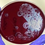 Clostridioides difficile, buone speranze dal trattamento con un lievito modificato