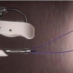 Complicanze chirurgiche: al Galliera il primo intervento con sutura endoscopica