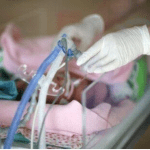 La ventilazione meccanica invasiva sincronizzata (PTV) nel neonato e il funzionamento del sensore di flusso