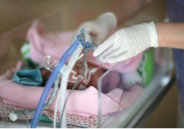 La ventilazione meccanica invasiva sincronizzata (PTV) nel neonato e il funzionamento del sensore di flusso
