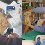 Nursing e monitoraggio clinico del paziente Covid-19 in Terapia Intensiva