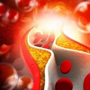 Colesterolo: in arrivo la rivoluzione dei nuovi farmaci