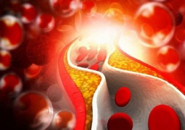 Colesterolo: in arrivo la rivoluzione dei nuovi farmaci