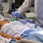 La pulizia del cavo orale è una pratica raccomandata non solo per il comfort del paziente ma anche per prevenire le infezioni da ventilazione meccanica