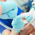 Coronavirus, Siaarti aggiorna le raccomandazioni per la gestione del paziente critico