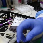 Il paziente testimone di Geova può rifiutare trasfusione