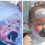 La dott.ssa Fumarulo presenta la tesi sulla gestione infermieristica nel trattamento del paziente gravemente ustionato