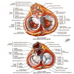 Management infermieristico del paziente con dissecazione dell’aorta in terapia intensiva