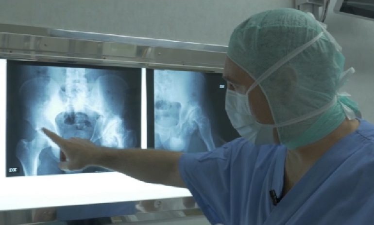 Protesi ortopediche: nel 2019 un intervento ogni 2,4 minuti