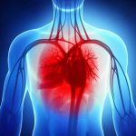 Transtiretina, bassi valori plasmatici associati a incidenza di insufficienza cardiaca