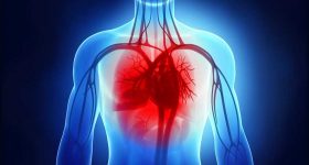 Transtiretina, bassi valori plasmatici associati a incidenza di insufficienza cardiaca