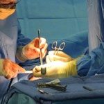 Trapianto di fegato da donatore Covid positivo in ricevente Covid positivo