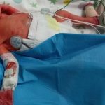 Bozza automatica 515