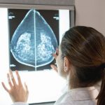 Carcinoma mammario metastatico: il possibile ruolo delle cellule tumorali circolanti