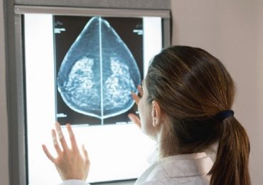 Carcinoma mammario metastatico: il possibile ruolo delle cellule tumorali circolanti