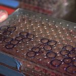 Coronavirus, cosa sono e come agiscono gli anticorpi monioclonali