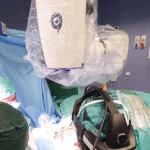 Eccezionale intervento a Torino: dito del piede trasferito sulla mano di un bimbo