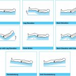 Le posizioni del paziente a letto
